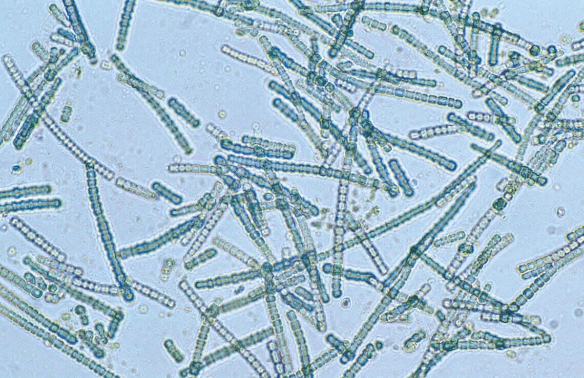 cyanobacteria free Wiki credit with link In: Some Cyanobacteria Are Deadly | Our Santa Fe River, Inc. (OSFR) | Protecting the Santa Fe River cyanobacteria free Wiki credit with link In: Some Cyanobacteria Are Deadly | Our Santa Fe River, Inc. (OSFR) | Protecting the Santa Fe River