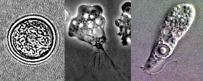 Naegleria fowleri lifecycle stages In: Brain-Eating Amoeba Found In Texas Water Supply | Our Santa Fe River, Inc. (OSFR) | Protecting the Santa Fe River Naegleria fowleri lifecycle stages In: Brain-Eating Amoeba Found In Texas Water Supply | Our Santa Fe River, Inc. (OSFR) | Protecting the Santa Fe River