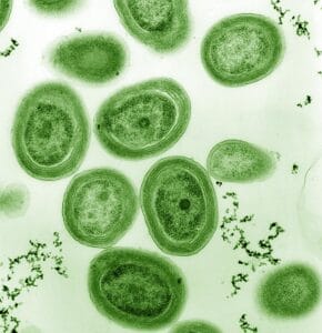 bluegreen algae pubdomain In: Blue-Green Algae Task Force Seeking Environmental Solutions | Our Santa Fe River, Inc. (OSFR) | Protecting the Santa Fe River