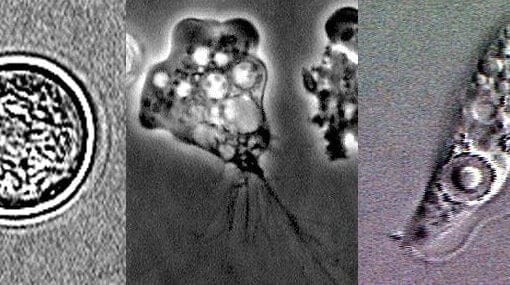 Naegleria fowleri lifecycle stages In: Brain-Eating Amoeba Found In Texas Water Supply | Our Santa Fe River, Inc. (OSFR) | Protecting the Santa Fe River